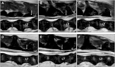 Dynamic Lumbosacral Magnetic Resonance Imaging in a Dog with Tethered Cord Syndrome with a Tight Filum Terminale